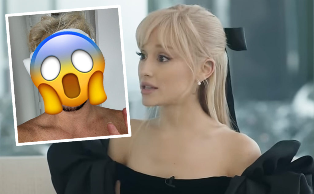 Ariana Grande Reacts To Brother Frankie's Brutal Nose Job Photo!