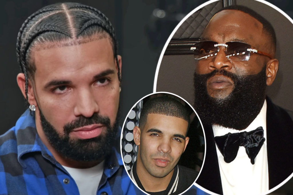 Did Drake Get A Nose Job?! Rick Ross Says So!